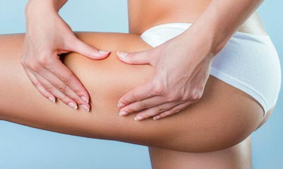 лечение целлюлита